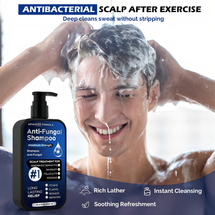 Champú Antifúngico Para Dermatitis Seborreica Y Caspa