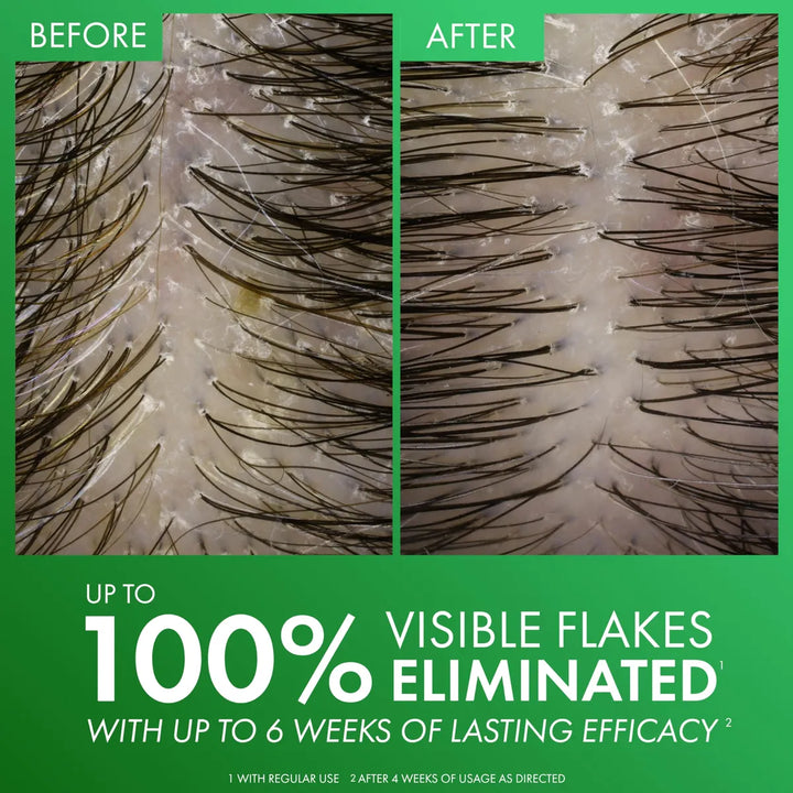 Champú Anticaspa Dercos Sulfuro De Selenio 200ml