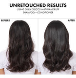 Champú Anticaspa Dercos Sulfuro De Selenio 200ml