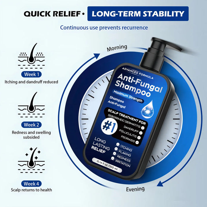 Champú Antifúngico Para Dermatitis Seborreica Y Caspa