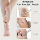 2 piezas de raspador y lima de pies de acero inoxidable - Ideal para eliminar la piel muerta de la palma, el pie y el dedo - No se necesita electricidad, esenciales para el cuidado de los pies | Herramientas de cuidado de pies de acero inoxidable | Diseñ