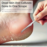 2 piezas de raspador y lima de pies de acero inoxidable - Ideal para eliminar la piel muerta de la palma, el pie y el dedo - No se necesita electricidad, esenciales para el cuidado de los pies | Herramientas de cuidado de pies de acero inoxidable | Diseñ